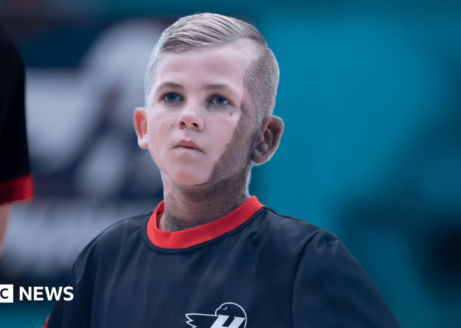 CMN birthmark no barrier for young footballing TV star
