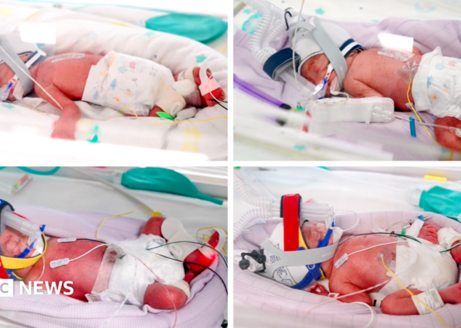 Rare identical quadruplets born in Australia