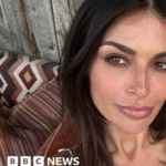 Endometriosis: I had to stop modelling because I kept passing out