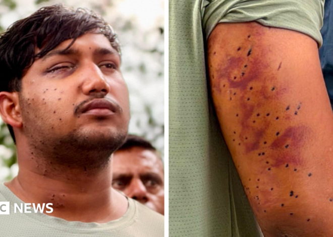 CJP protest: India’s ‘Cockroach’ protesters have wounds consistent with pellet-gun fire, experts say