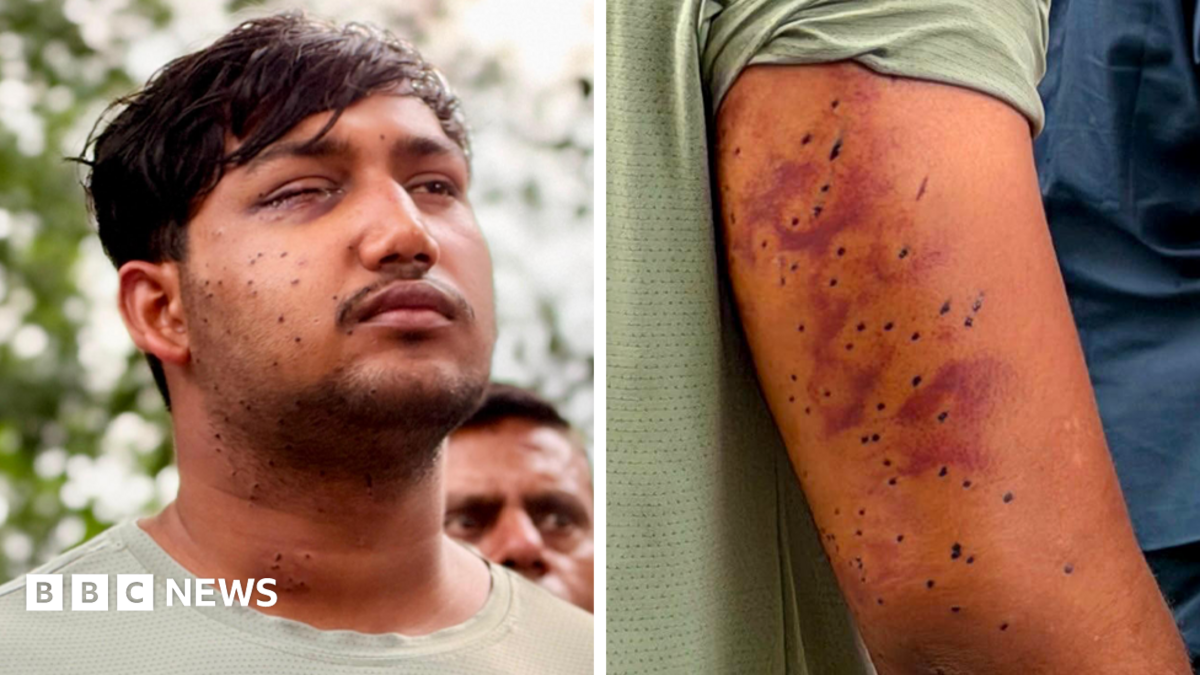CJP protest: India’s ‘Cockroach’ protesters have wounds consistent with pellet-gun fire, experts say
