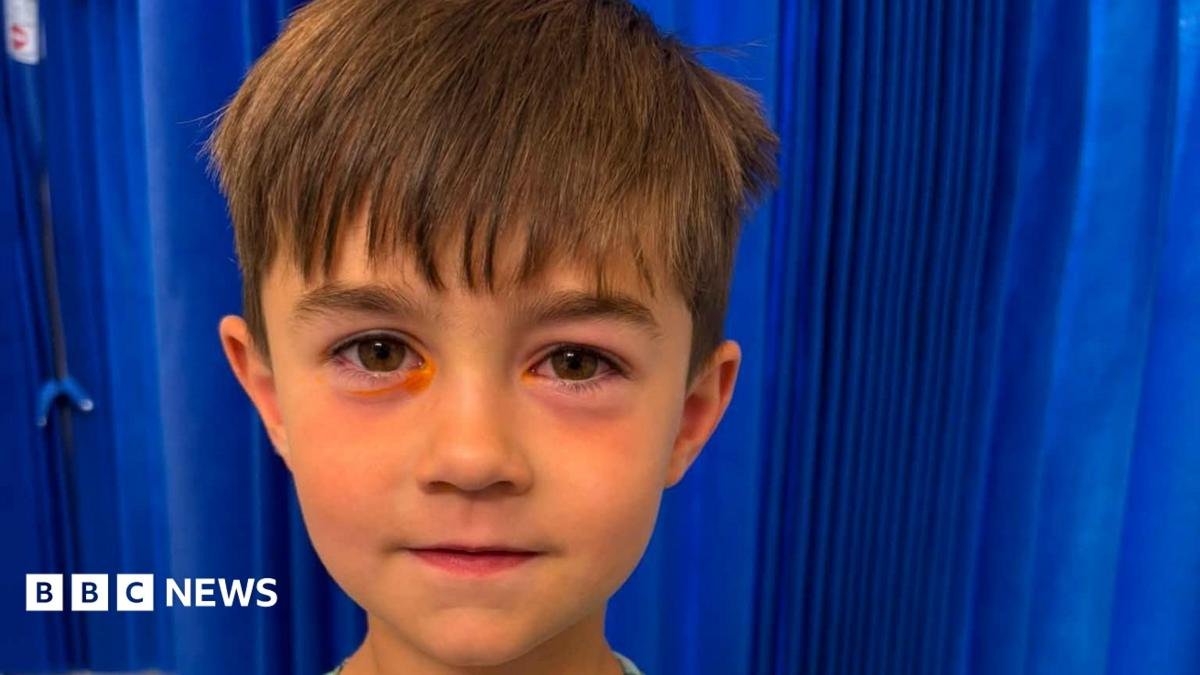 Shein fake squishy toy explodes in Bridgend boy’s face