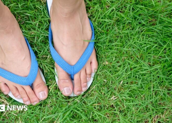 From flip flops to fisherman’s sandals: Are your summer sandals killing your feet?