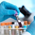 England set to eliminate hepatitis C
