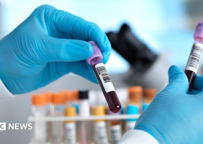 England set to eliminate hepatitis C