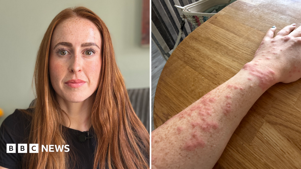 Cambridge Travelodge bed bugs ordeal ‘tarnishes’ woman’s stay