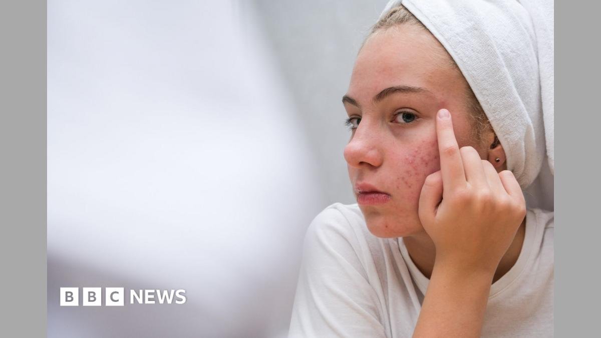 The simple skincare routine for teens that actually works – and five expert tips