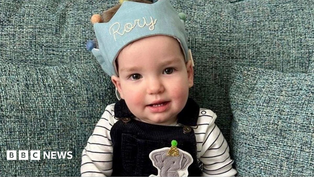 World-first surgery for Chesterfield baby’s rare skull condition
