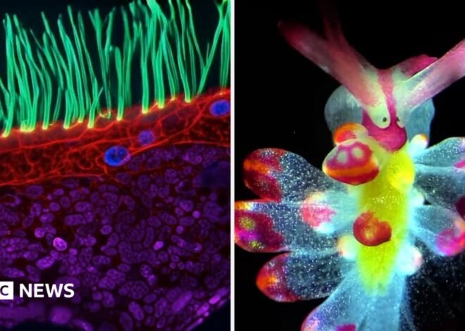 See tiny organisms on show in microscopic video competition