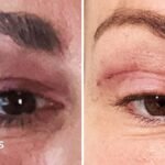 Watch: ‘My eyelids became infected – I was scared to sleep’