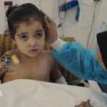 Girl has multiple surgeries to control infections after strike in Gaza