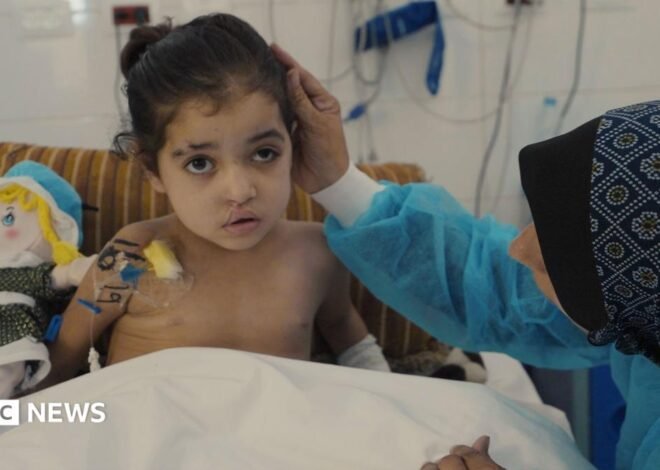 Girl has multiple surgeries to control infections after strike in Gaza